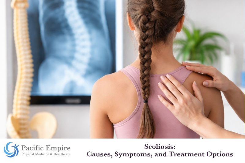 Scoliosis: Causes, Symptoms, and Treatment Options