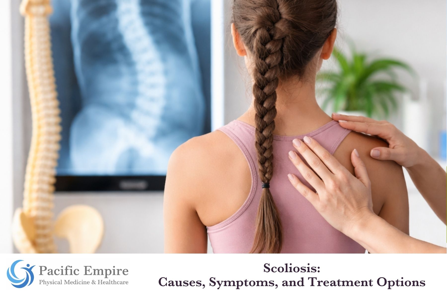 Scoliosis: Causes, Symptoms, and Treatment Options